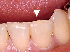 術後写真